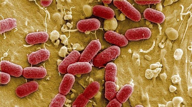 e-coli